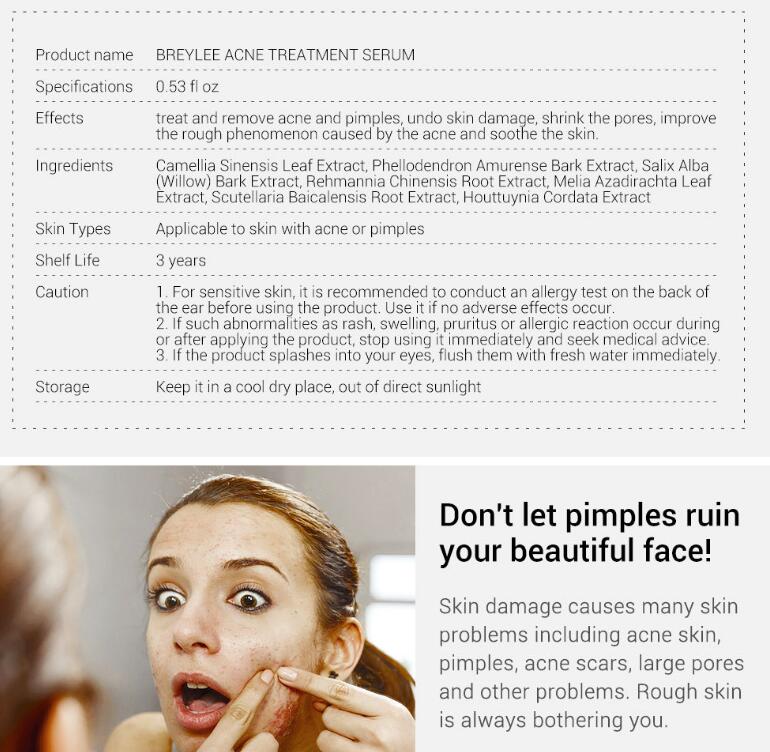 Acne Removal Serum