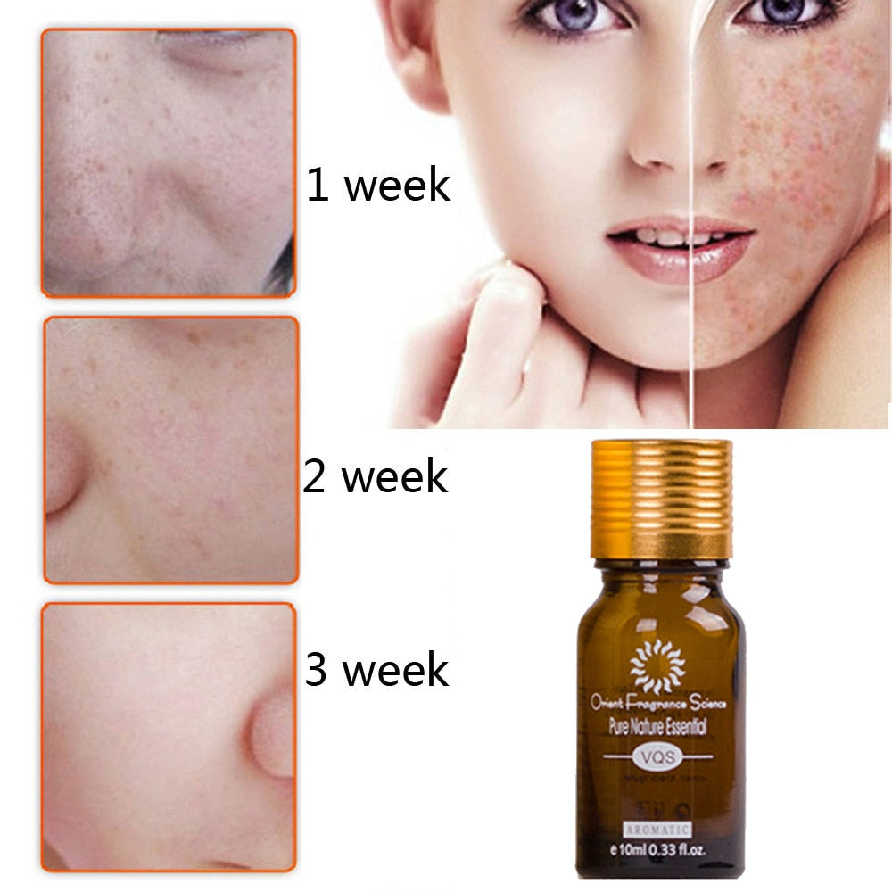 Acne/Scar Removal Oil