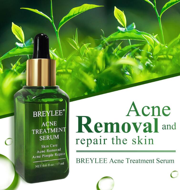 Acne Removal Serum